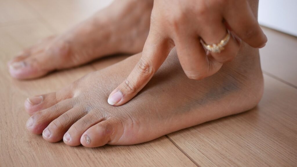 How to Properly Care for Diabetic Feet to Avoid Complications