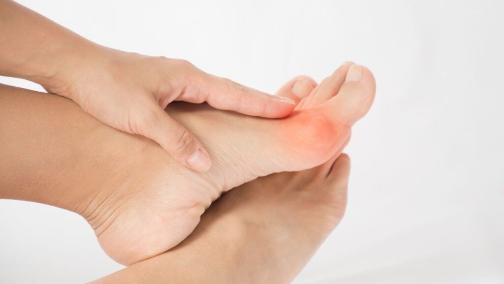 Bunions — when orthotics are enough and when surgery may be required?