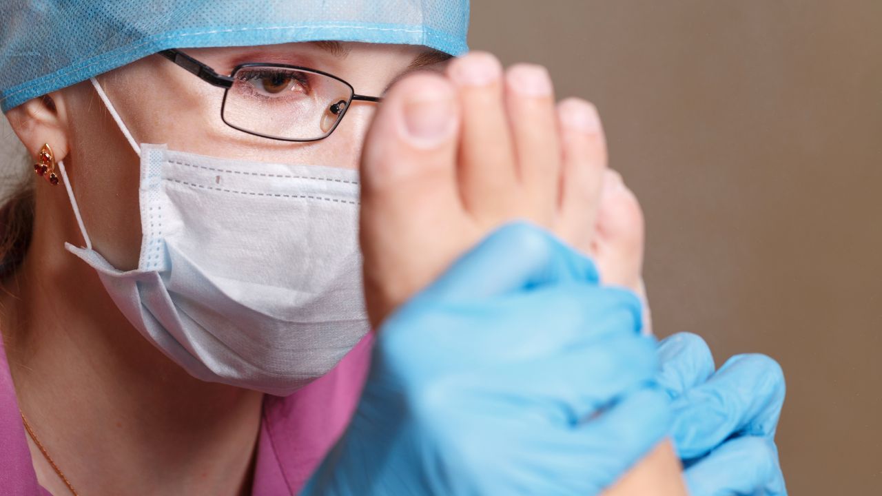 Corns and calluses — home remedies vs professional foot care