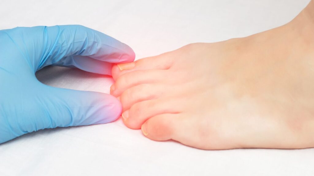 Ingrown nails — the treatment process and when to seek professional help?