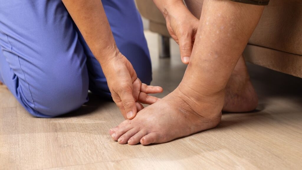Swelling around the ankle – when is it a sign of a serious issue?